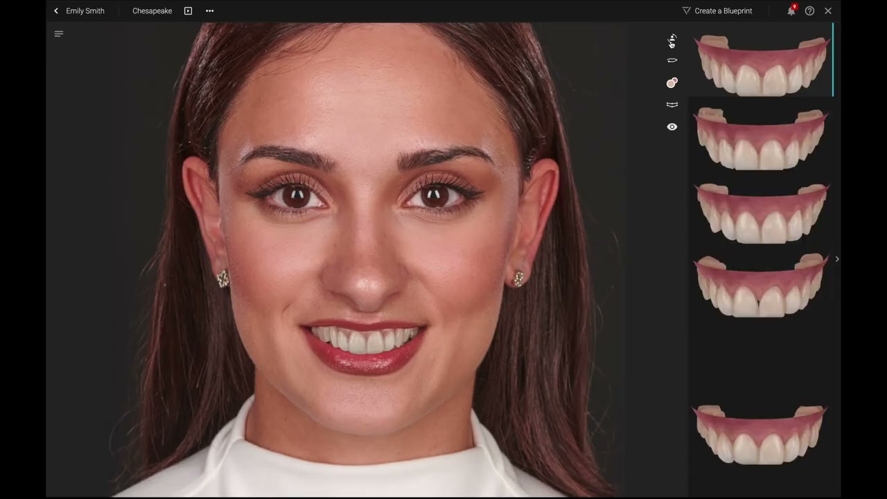 Smilecloud Tutorial 3DNA  AI Smile Design and Cloud Dentistry   Digital Dentistry Masterclass 2160p,