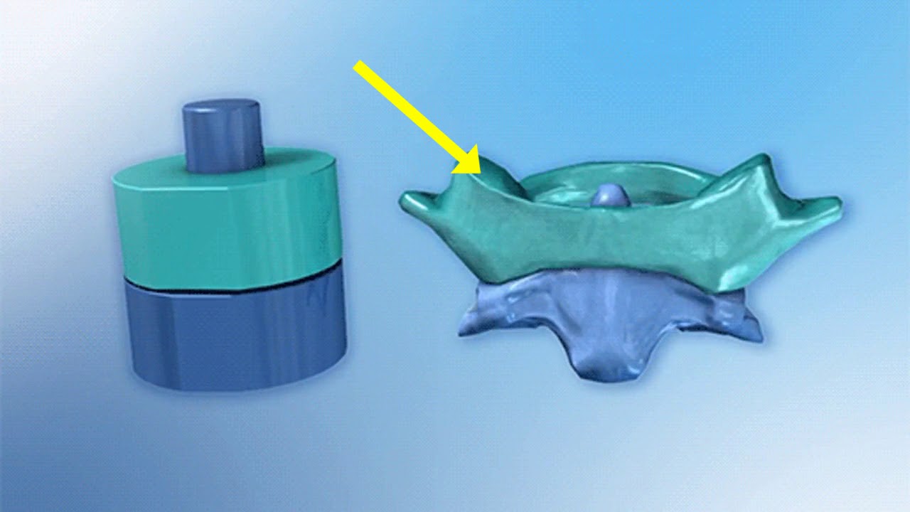 6 Types of Synovial Joints