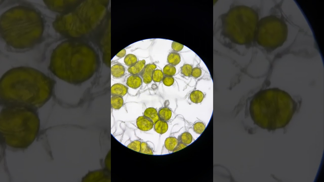 Equisetum Arvense spores microscope / Heermoes sporen microscoop