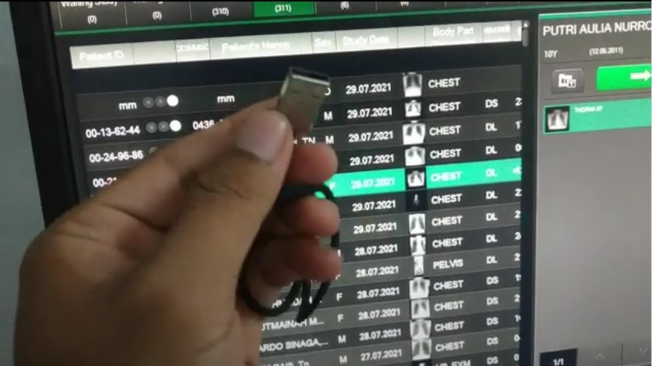 CARA copy (ambil)  file DICOM dari CR ( computed radiography) FUJIFILM pcr prima TM
