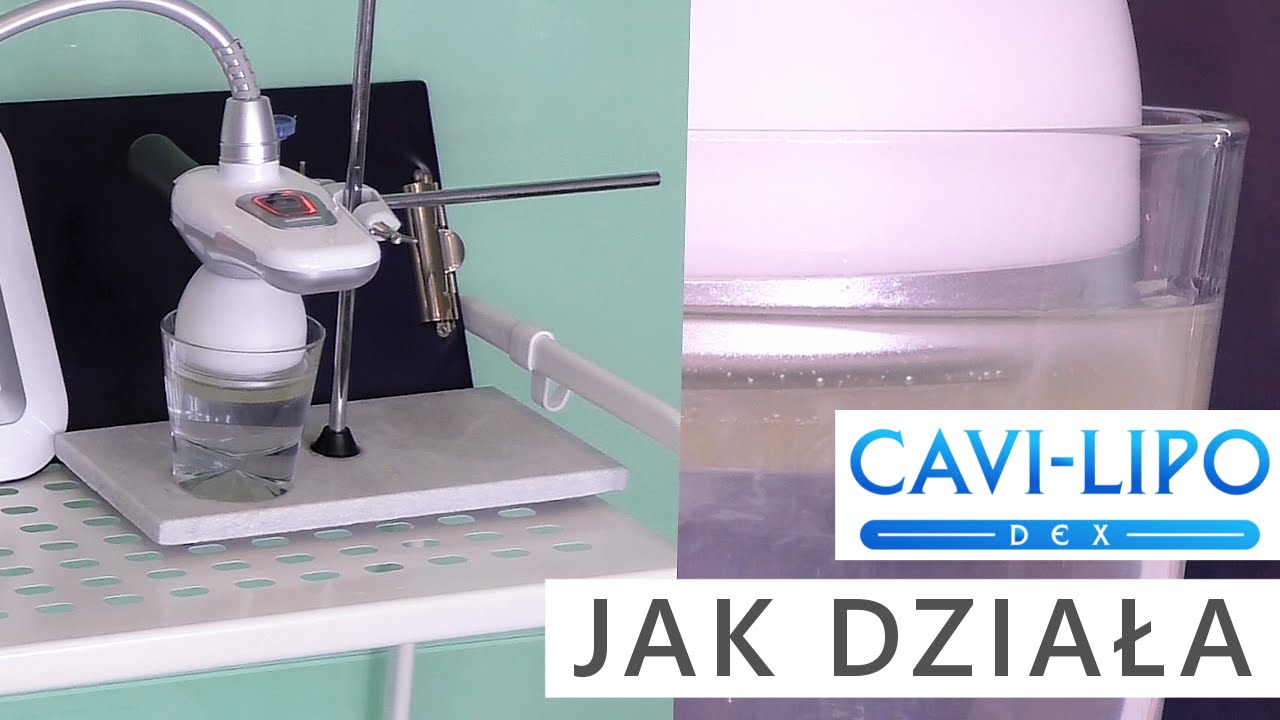 CAVI LIPO DEX - jak działa bezinwazyjna metoda niszczenia komórek tłuszczowych