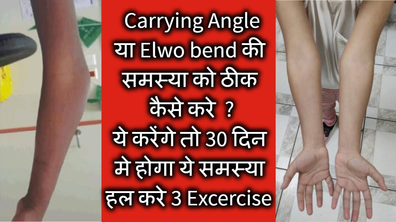 Elbow Bend And Carrying Angle Problem Solve in 30 days with  3 Easy Exercise For Army Training ||