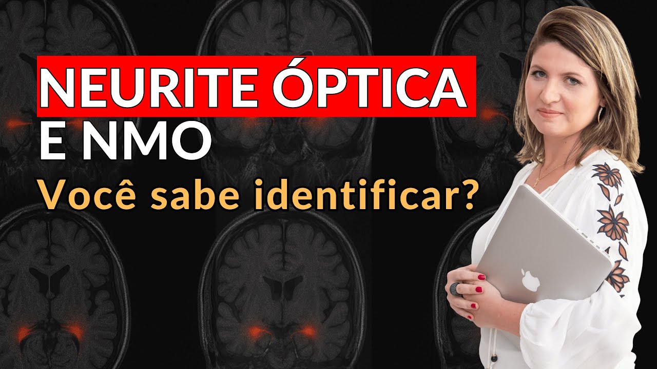 Saiba COMO IDENTIFICAR NEURITE ÓPTICA em 16 minutos