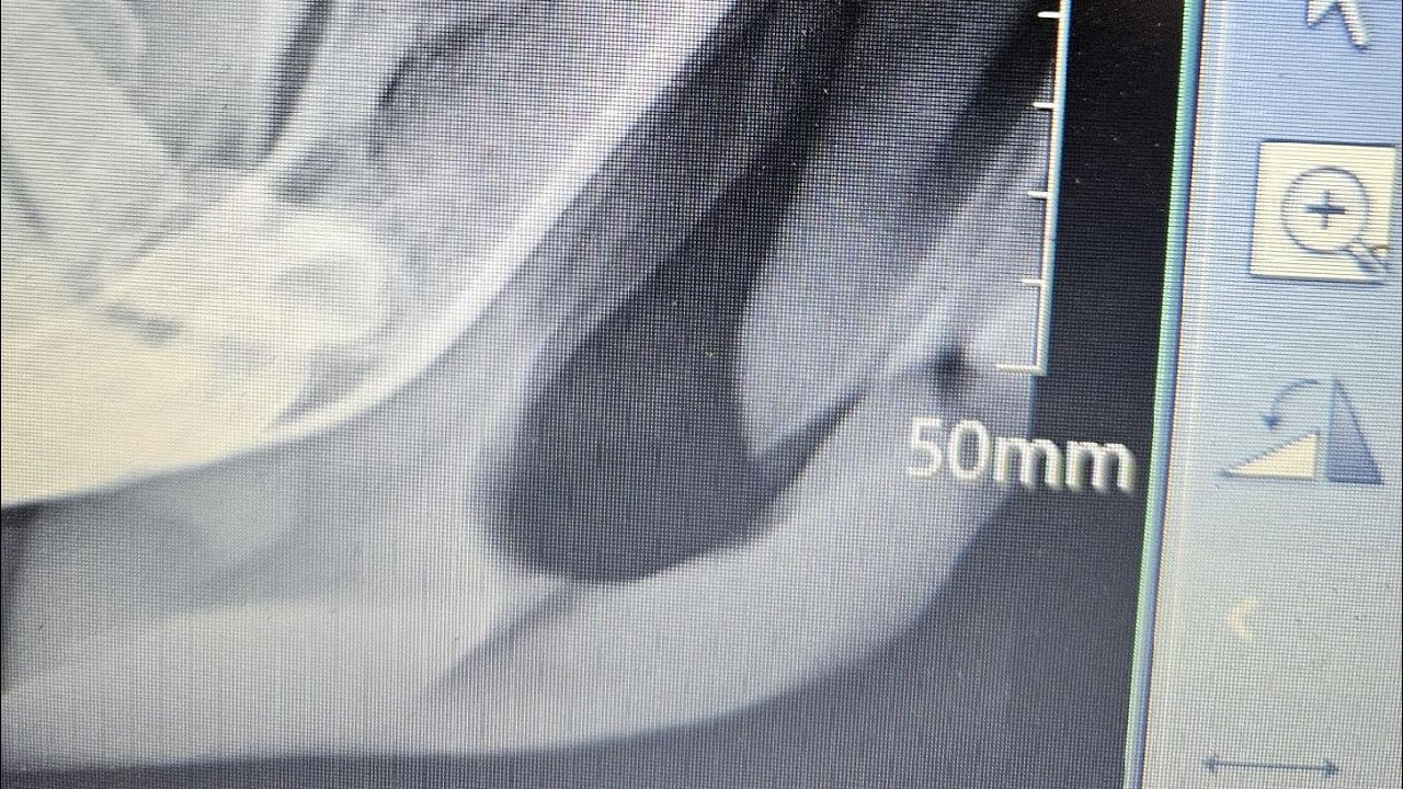 Broken Jaw On A Young Horse, Will It Heal~ Horse Poor 