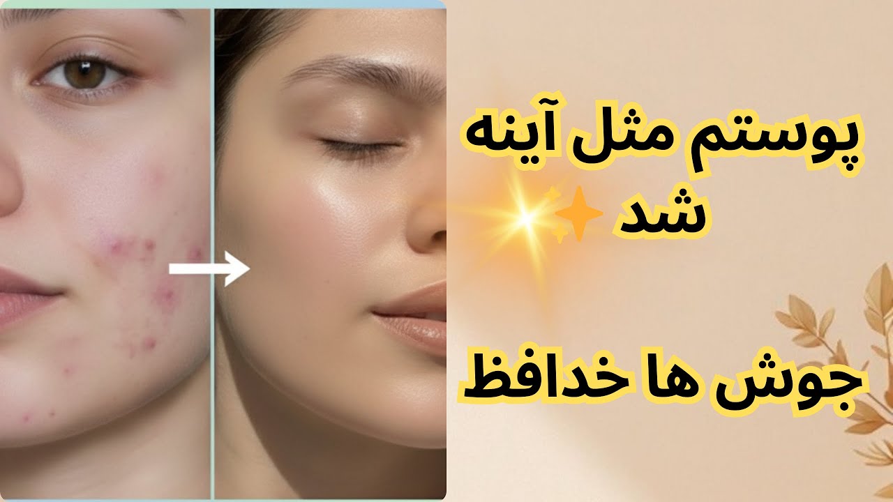 راز پوست صاف و بدون لک! فقط با حذف این اشتباهات😍