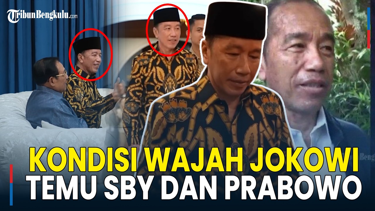 Penampakan Kondisi Wajah Jokowi Saat Bertemu Prabowo Hingga SBY di Istana Negara, Terlihat Membaik?