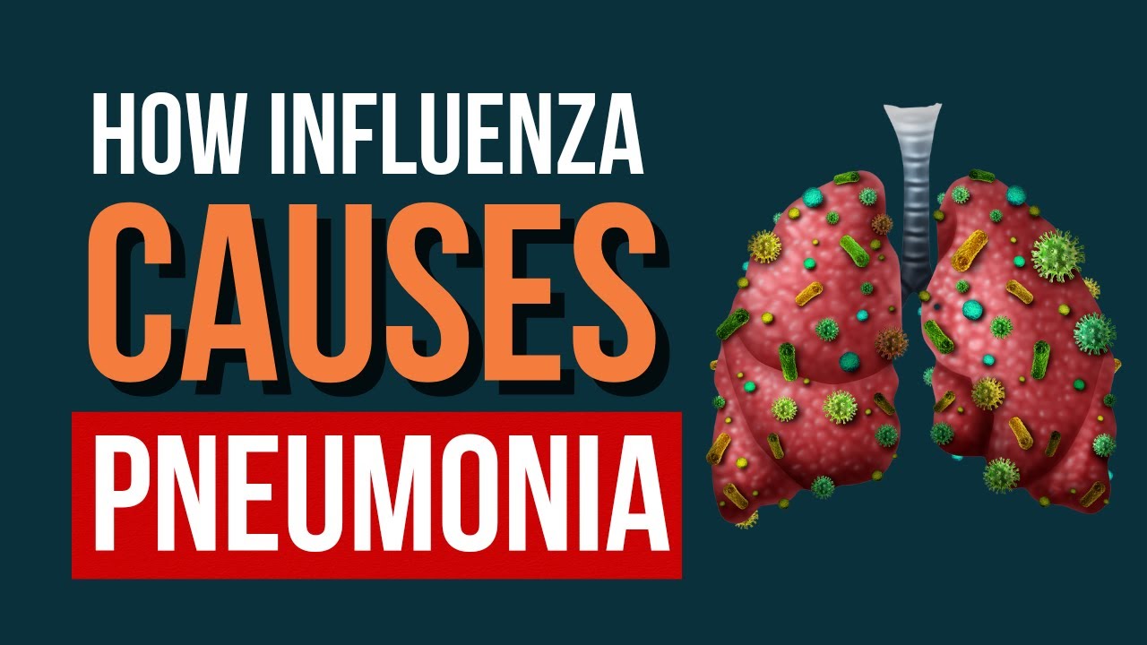 The Deadly Duo: How Influenza and Pneumonia Team Up to Attack Your Lungs