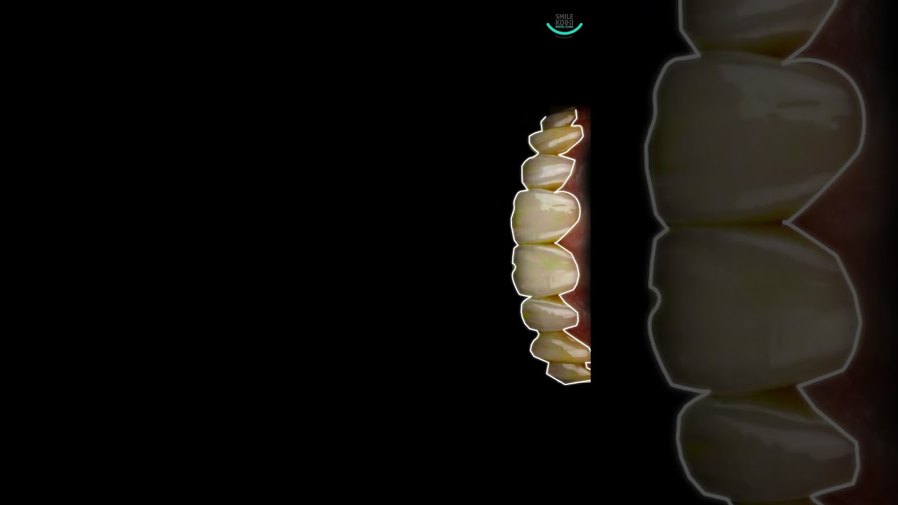 Smile Kochi Dental Clinic +91 7999995339 PALARIVATTOM,KADAVANTHARA,EDAPPALLY, KAKKANAD.