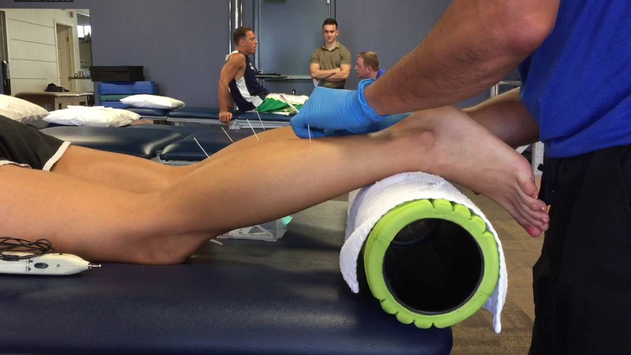 What to Expect in during a Dry Needle Session