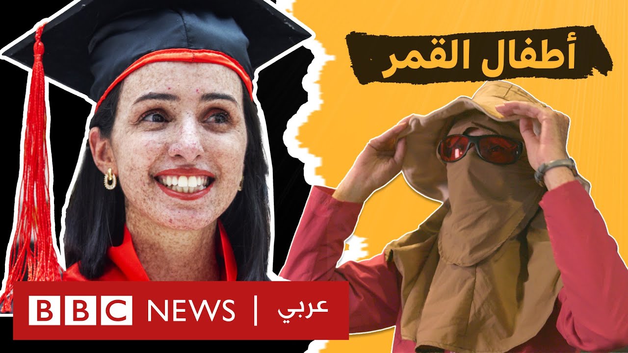 قالوا لن أصلح للزواج والدراسة لكنني اليوم دكتورة