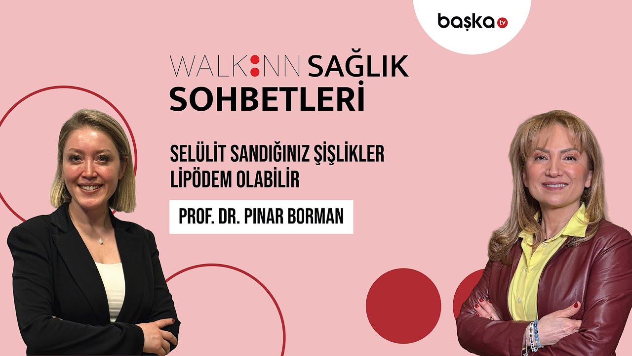 Selülit Sandığınız Şişlikler Lipödem Olabilir