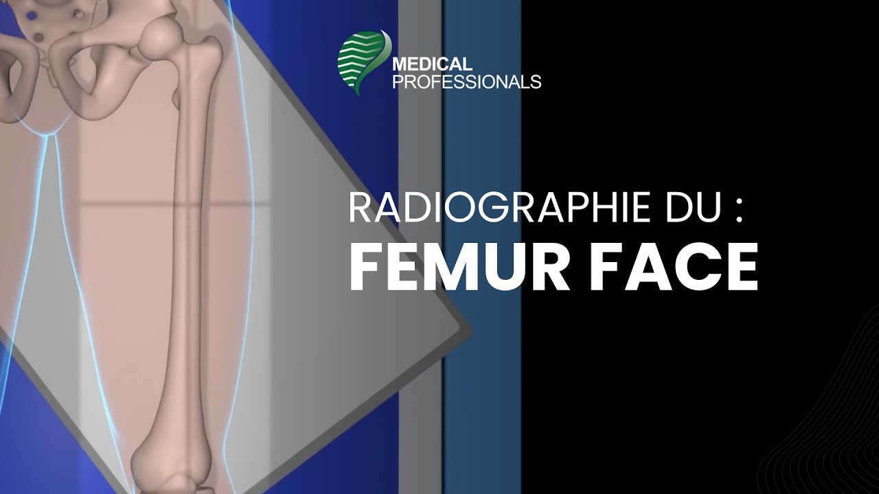 Incidences : Radiographie du FEMUR FACE