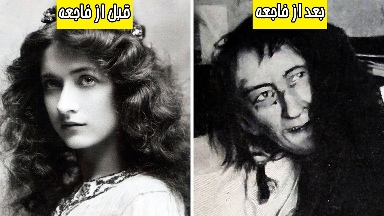 وحشتناک ترین بلاهایی که امکان داره سر انسان بیاد