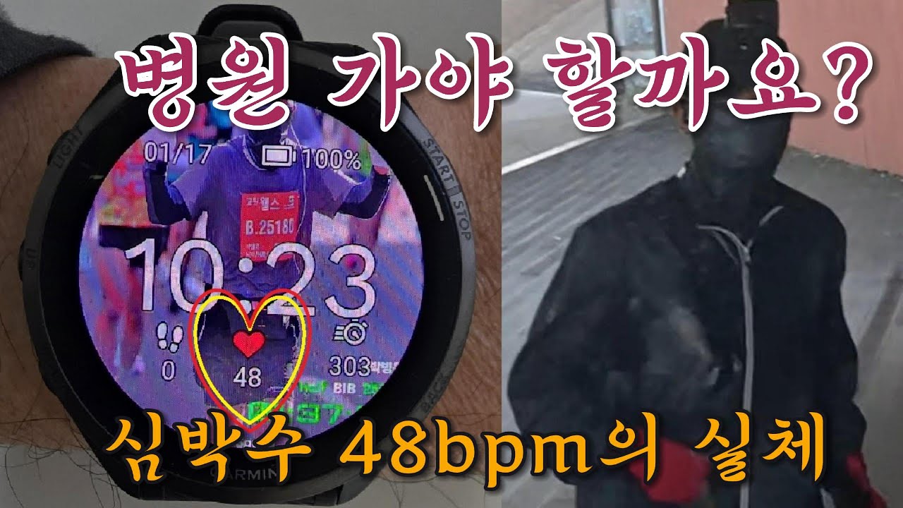 60대인데 심박수가 48? 병원 가야 할까요? (서맥과 스포츠심장의 차이)