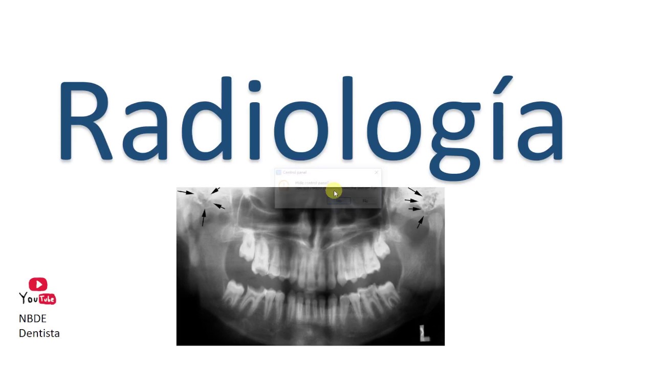 Radiografias Interesantes.