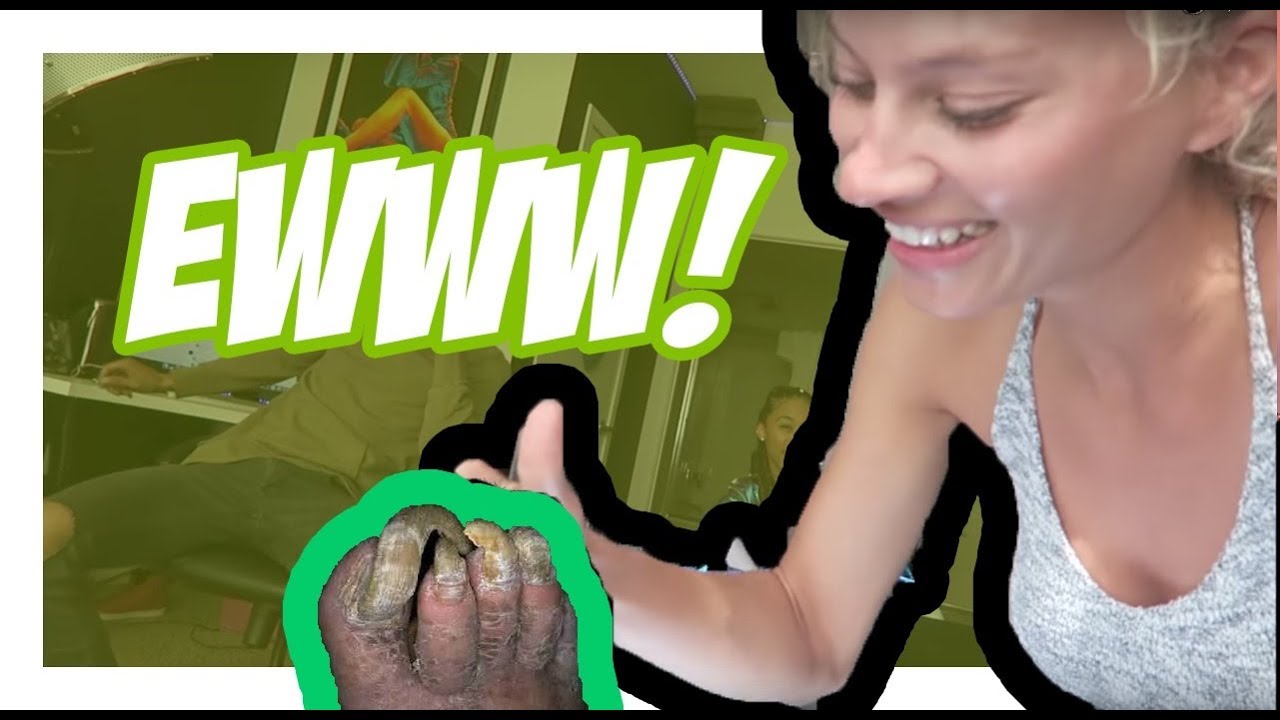HIS TOES ARE HILARIOUS!!!