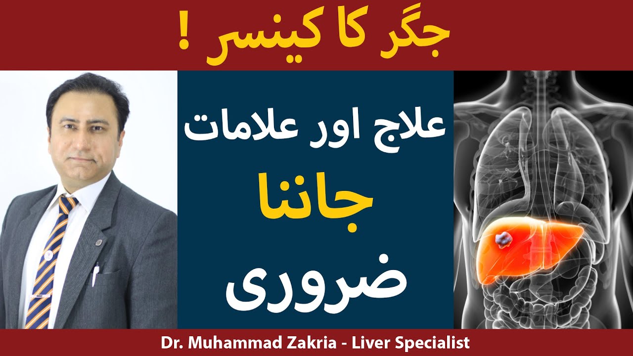 Jigar Ka Cancer Ka Ilaj | Liver Cancer Treatment In Urdu/Hindi  | Jigar Ka Cancer Ki Alamat In Urdu