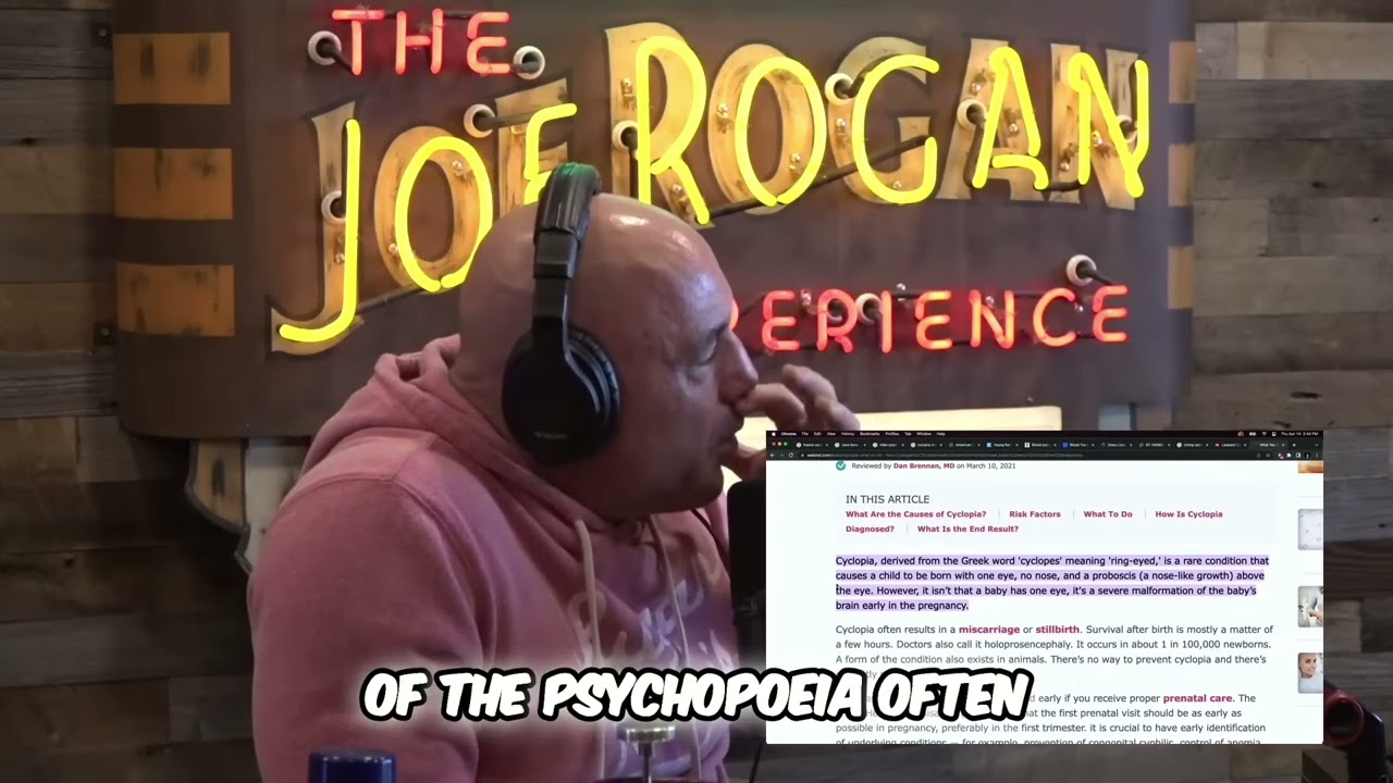Understanding Cyclopia: Joe Rogan & Mike Tyson Discuss a Rare Congenital Condition