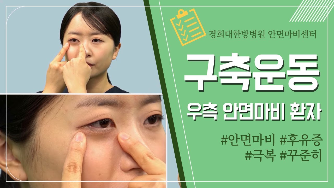 [경희대한방병원] 안면마비 후유증 극복! 구축(우측 안면 마비 환자)