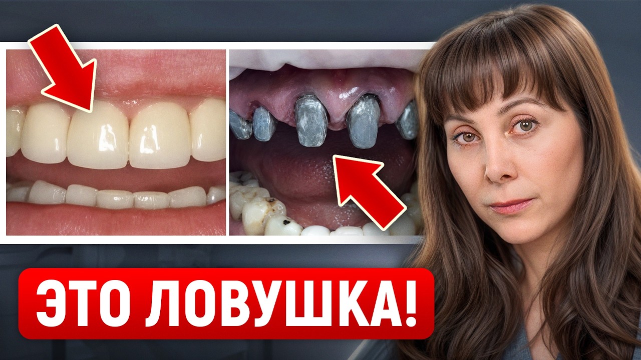 ВСЯ ПРАВДА про МЕТАЛЛОКЕРАМИКУ И ЦИРКОНИЙ! Какие коронки выбрать в 2026?