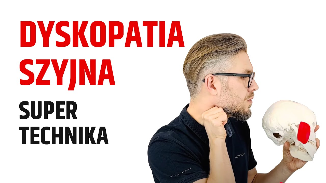 DYSKOPATIA SZYJNA, RWA BARKOWA – SUPER TECHNIKA ZMNIEJSZAJĄCA UCISK – DR N. MED. MARCIN WYTRĄŻEK