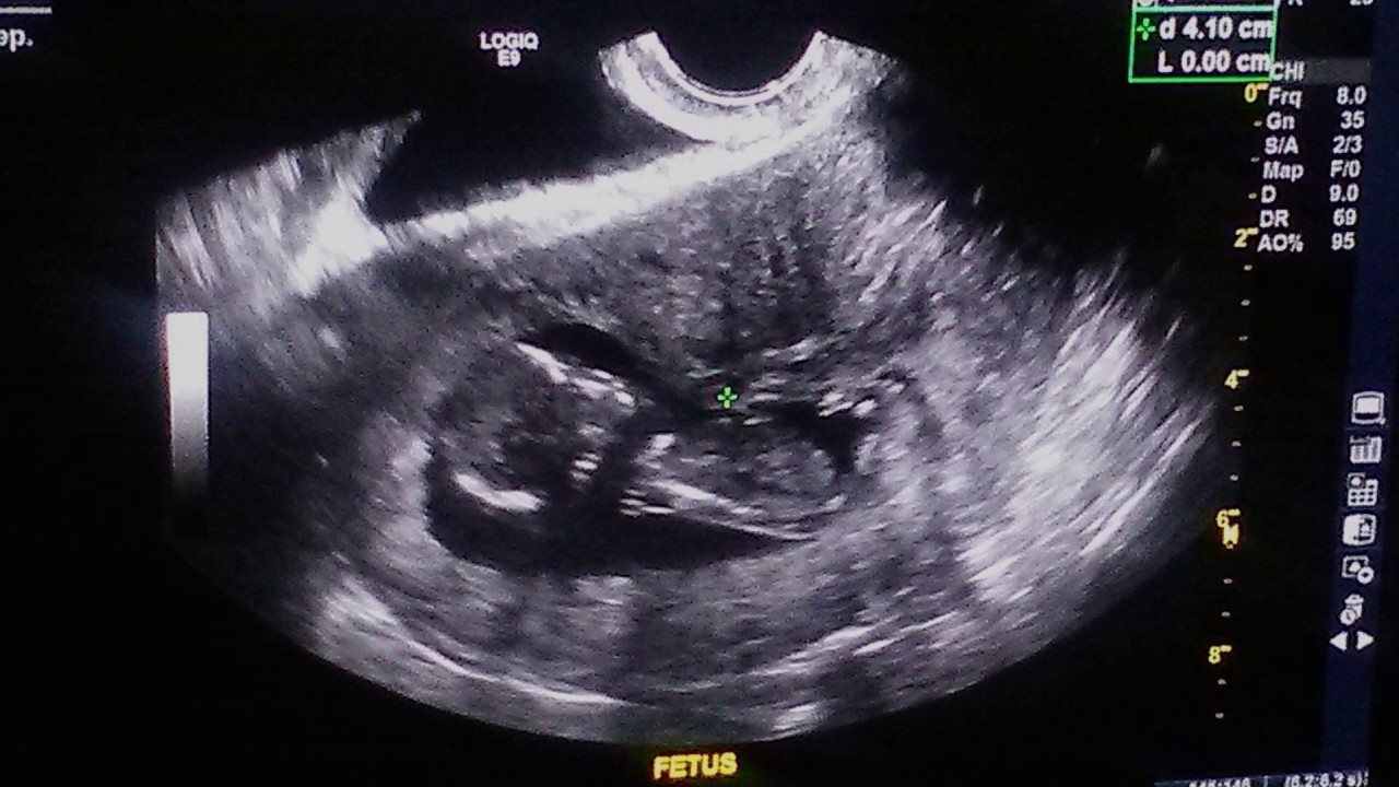 Rest in Peace Seth Michael Graves 8-30-18 -12-30-18