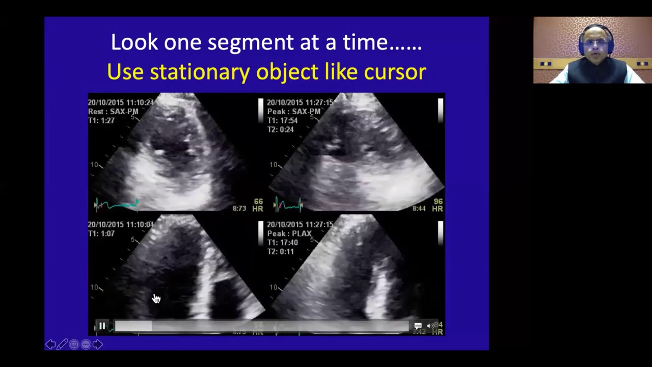 Stress Echocardiography Dr  Nitin Burkule
