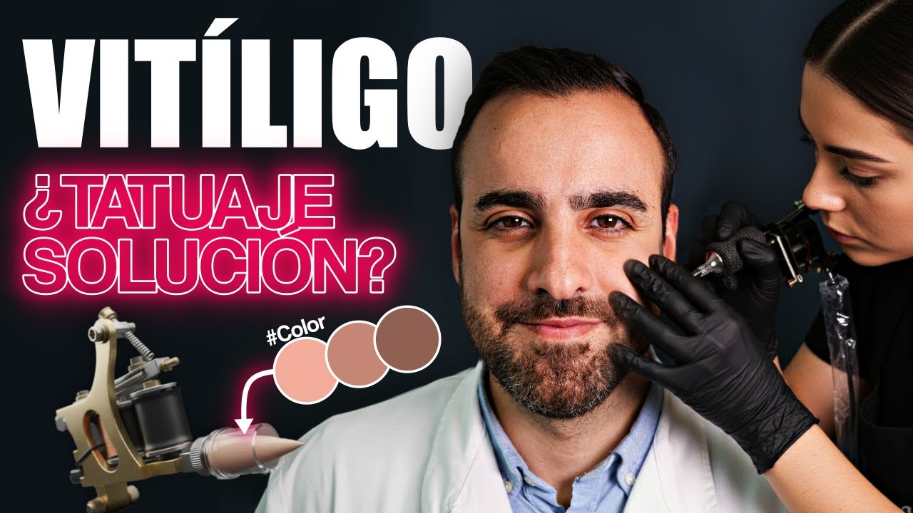 VIT&Iacute;LIGO: &iquest;Tatuar tus Manchas es una SOLUCI&Oacute;N o una PESADILLA?