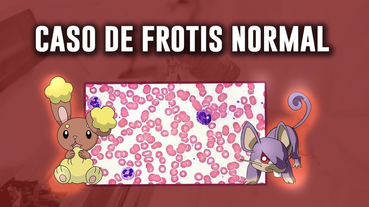 ¿Cómo se observa un FROTIS de SANGRE NORMAL? | Descripción de caso y células encontradas
