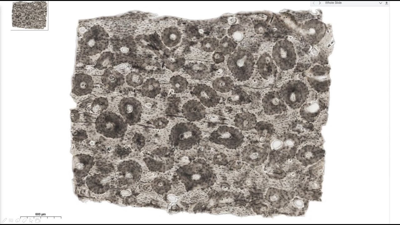 Histology - Specialized Connective Tissue