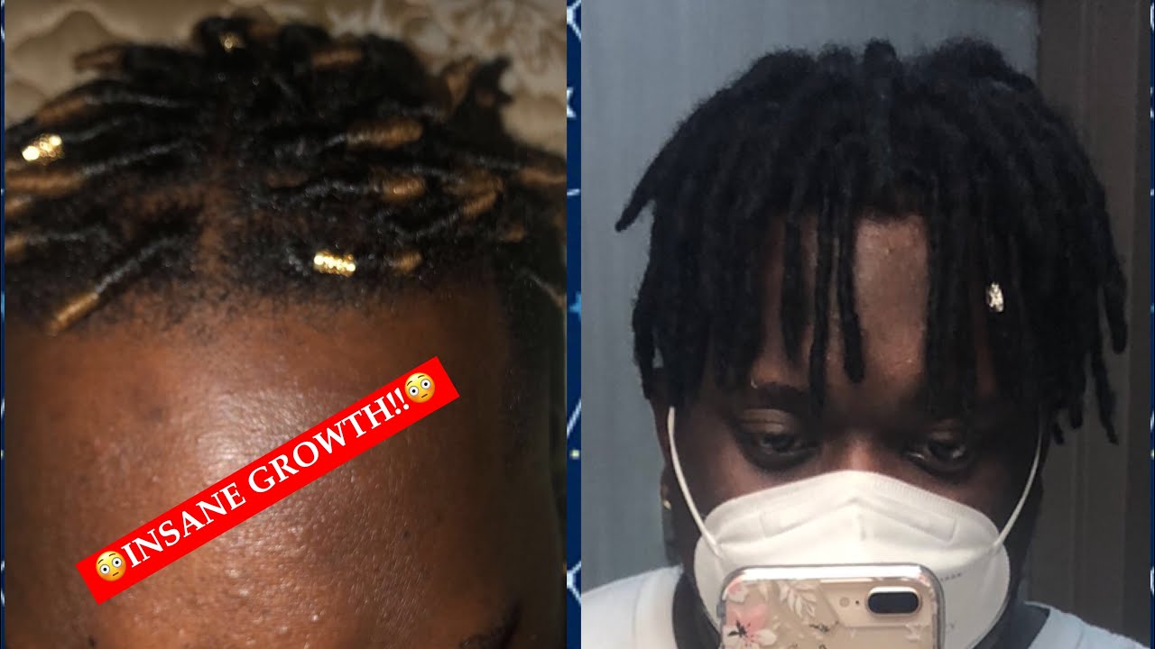 1 YEAR HIGHTOP / DROPFADE LOC JOURNEY‼️ CRAZY GROWTH‼️