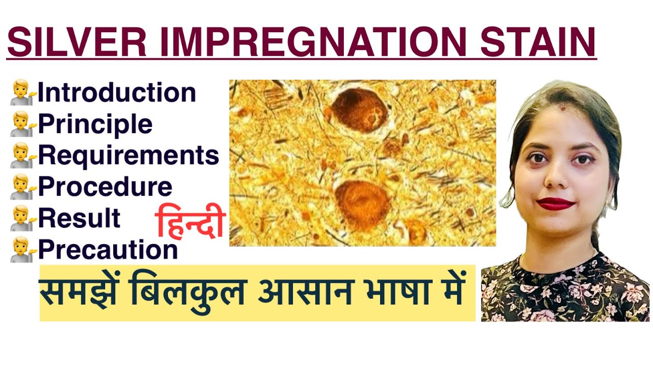 Silver impregnation stain in Hindi | Special Stain | Histopathology | MLT