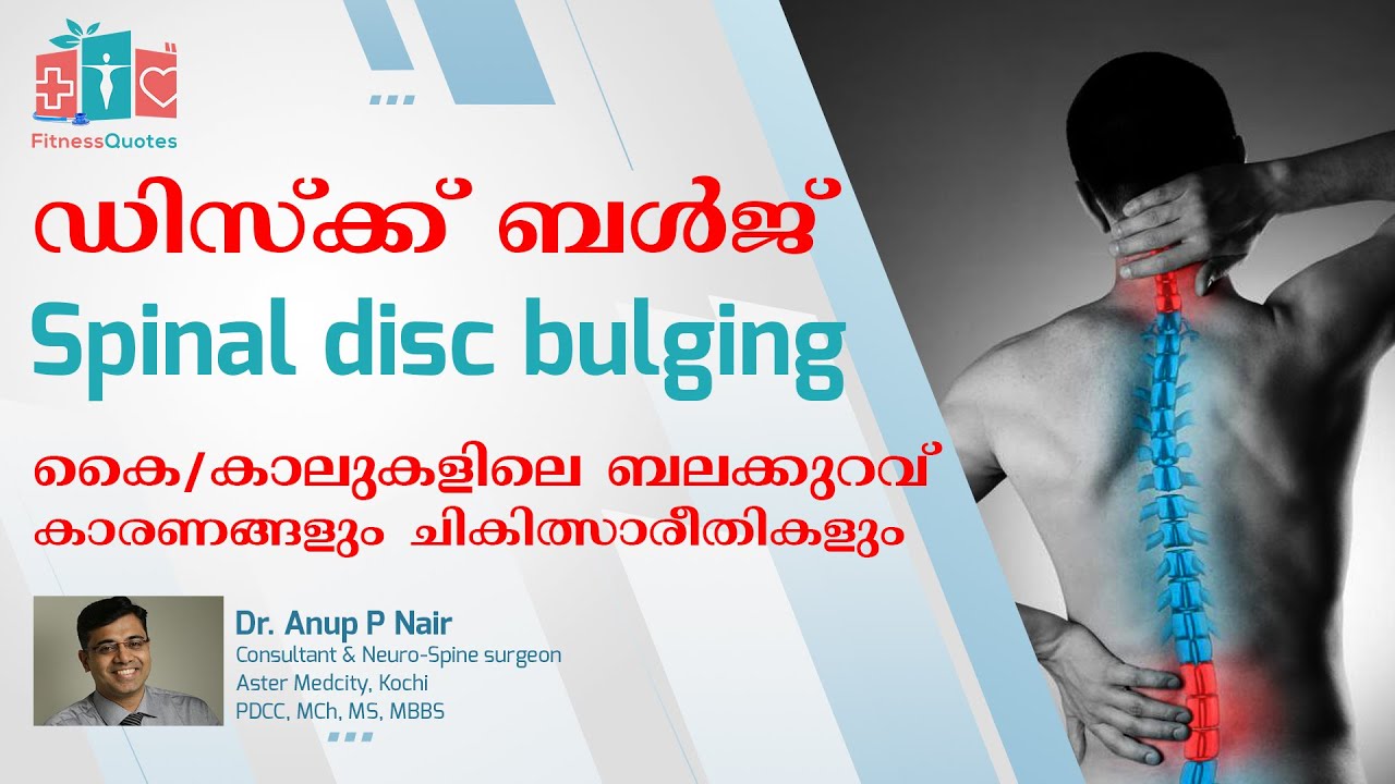 Back Pain | Disc Bulge | Disc Problem | ഡിസ്ക് തെന്നി മാറിയാൽ / ഡിസ്ക് പ്രശ്നങ്ങൾ