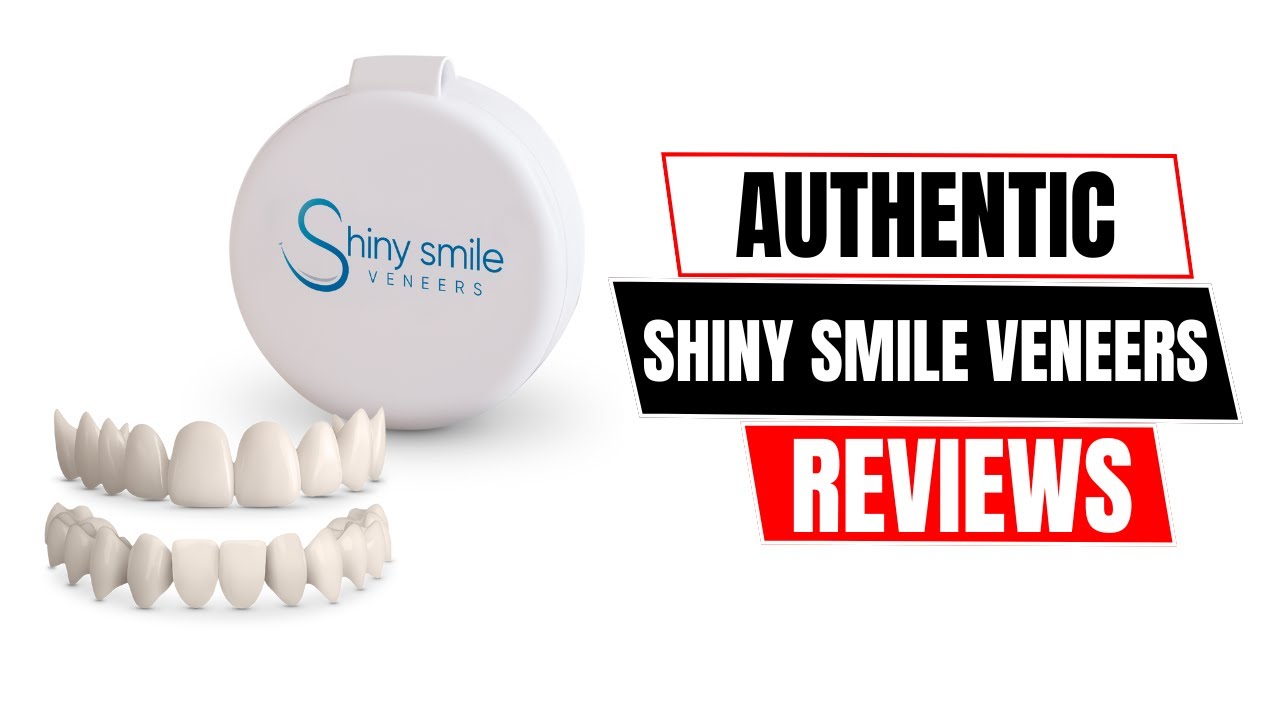 Отзывы о винирах Shiny Smile Veneers: посадка, комфорт и внешний вид через 1 месяц!