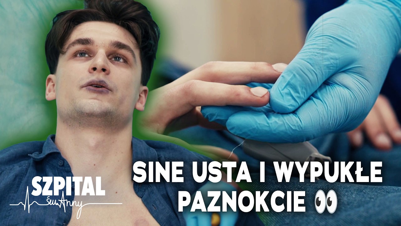 21- LATEK MIAŁ NIEDOTLENIONY ORGANIZM❗LEKARZA ZANIEPOKOIŁY WYPUKŁE PAZNOKCIE | Szpital św. Anny