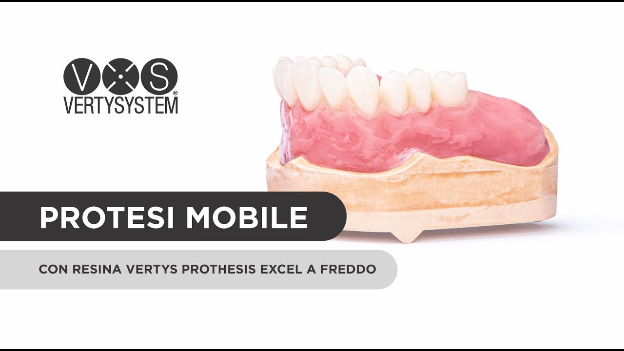 Come fare una Protesi Mobile con Vertysystem per iniezione 🤩