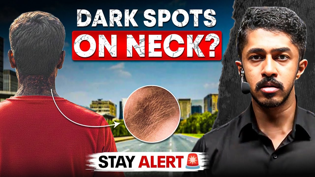 Is Your Neck Getting Dark? It Might Be Dangerous! Stay Alert 🚨