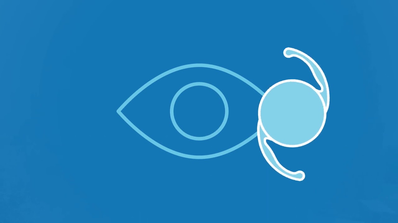 The Only Trifocal IOL in the USA for Cataract Surgery