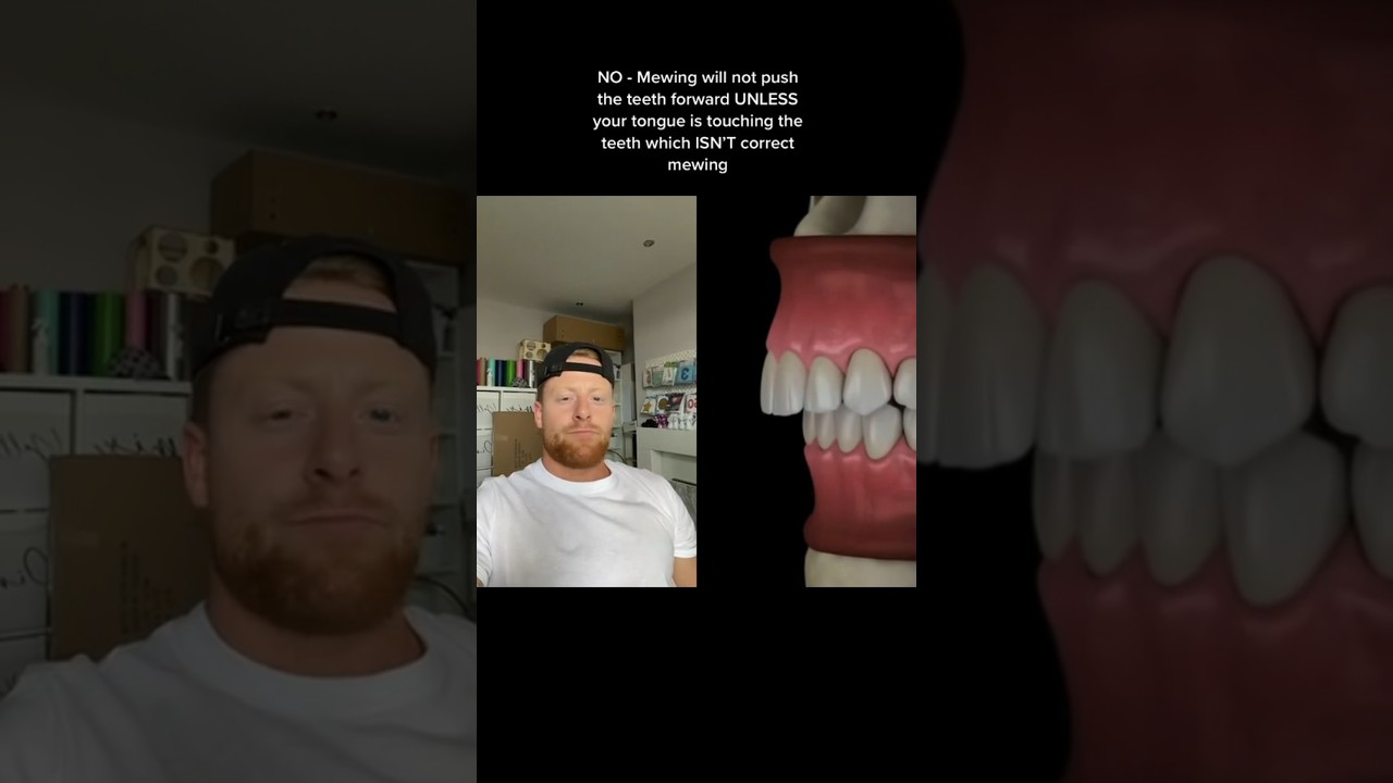 Does mewing push the front teeth forward?