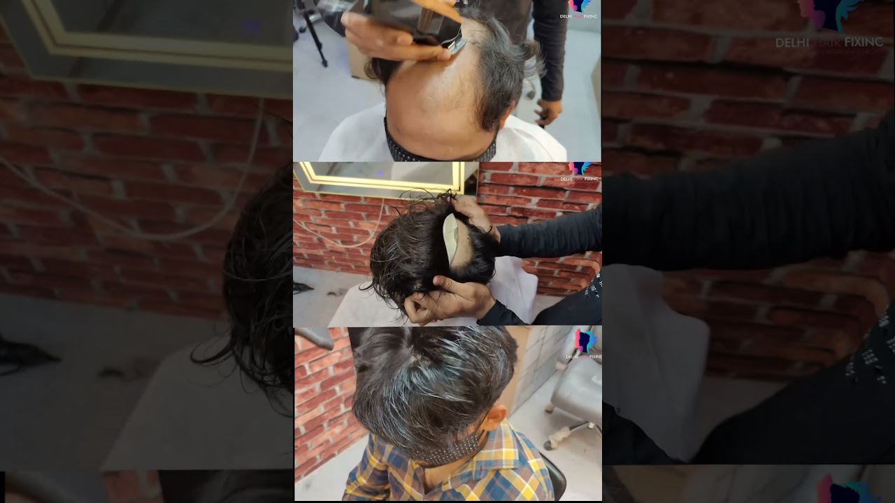 Latest Mirage Hair System Review | Miraj Hair Patch | Hair patch Styles #shorts #youtubeshorts