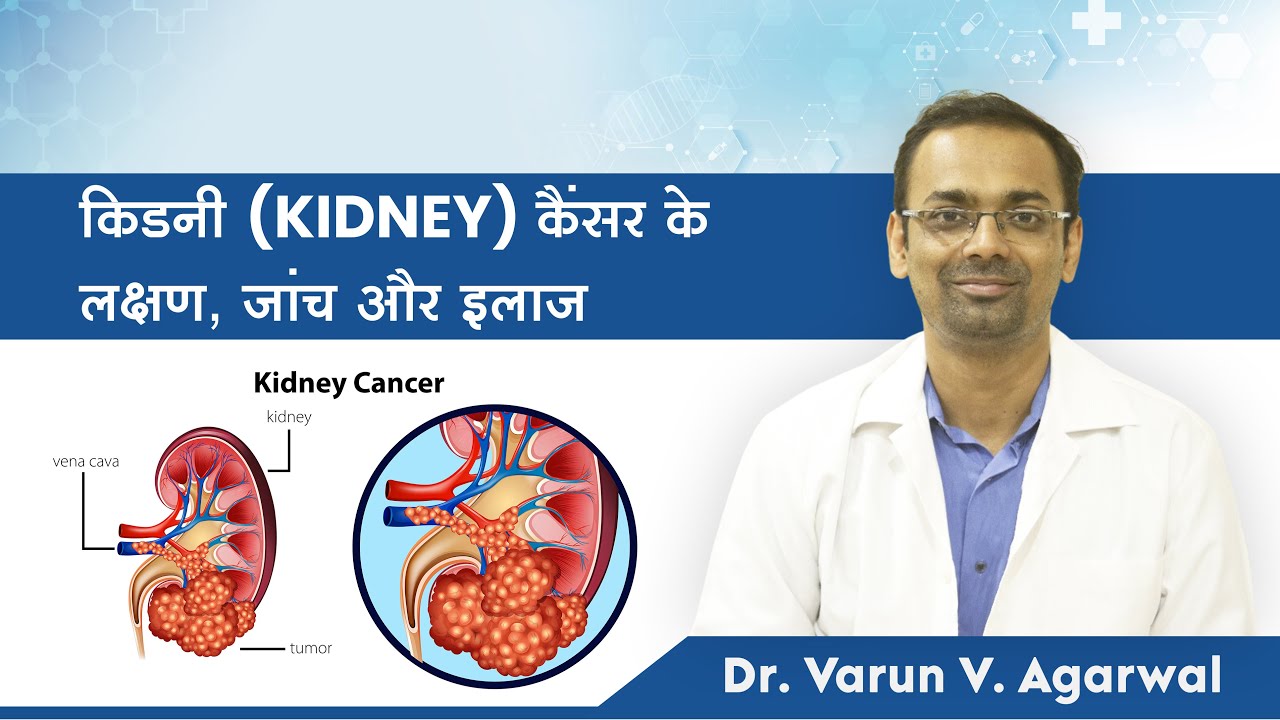 किडनी कैंसर| Kidney Cancer | Causes | Symptoms | Prevention |Treatment | Dr. Varun Agarwal(in Hindi)