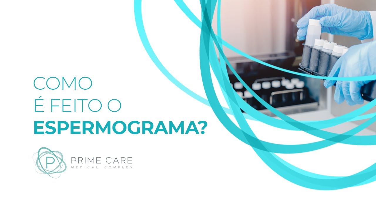 Como é feito o Espermograma ou Análise do Esperma? Dr. Fábio Tanno Urologista pela USP responde!