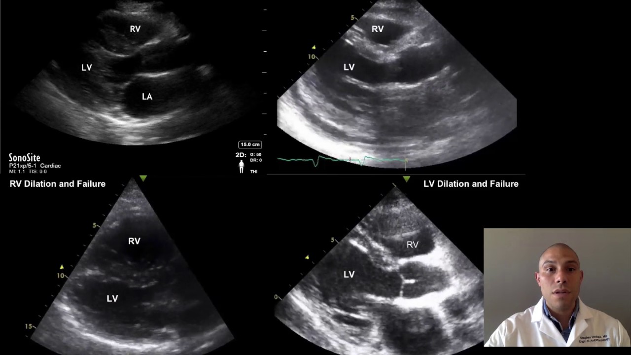 Webinar: Focused Cardiac Ultrasound (FoCUS)