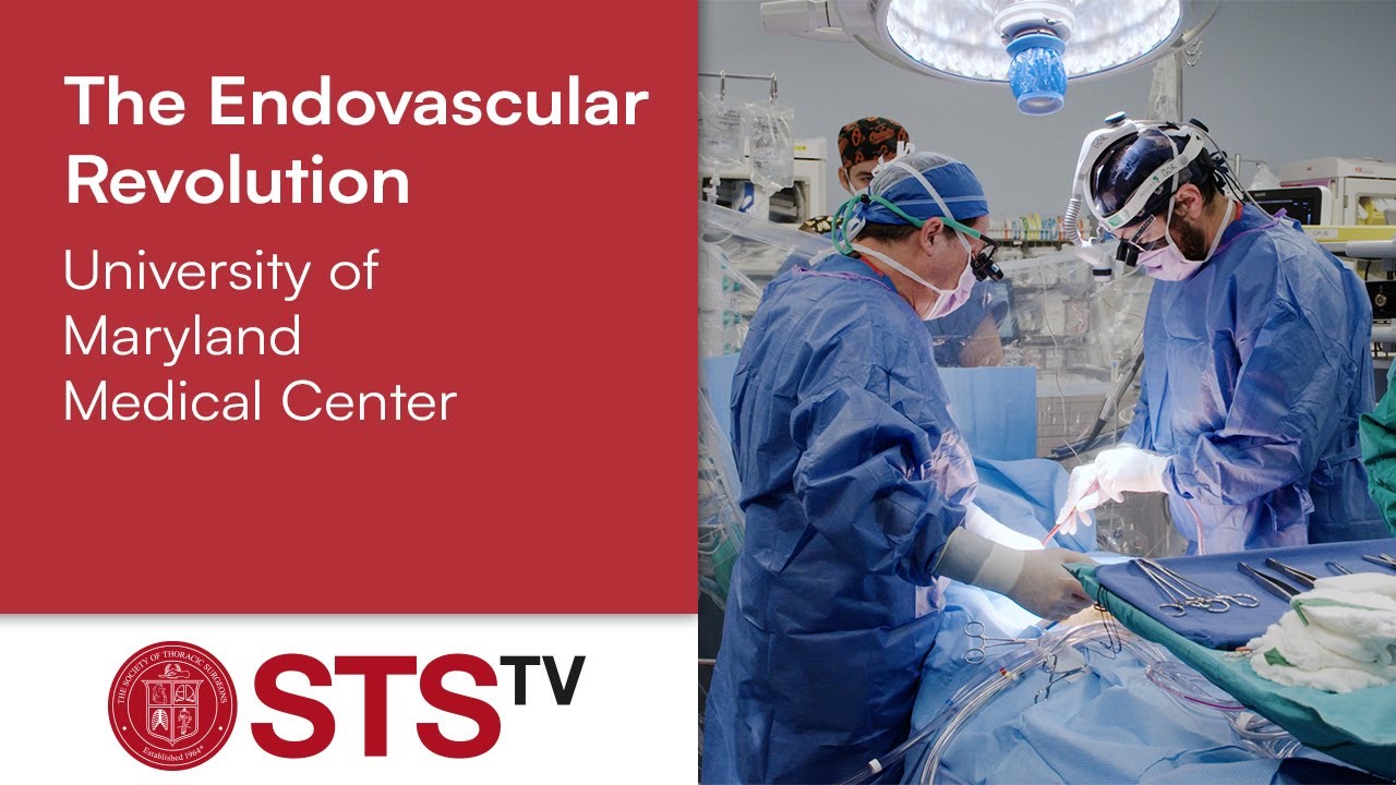 The Endovascular Revolution – University of Maryland Center for Aortic Disease