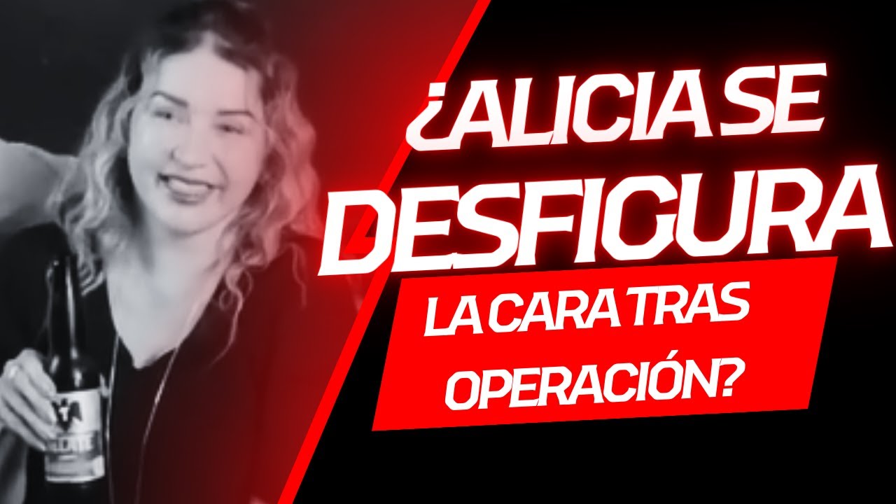 ¿SI SE OPERÓ LA CARA ALICIA VILLARREAL?📱