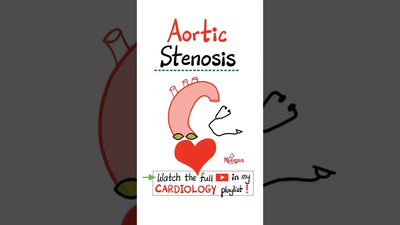 Aortic Stenosis (AS) - Valvular Heart Disease (VHD)..#science #doctor #nurse #cardio #mbbs #nclex