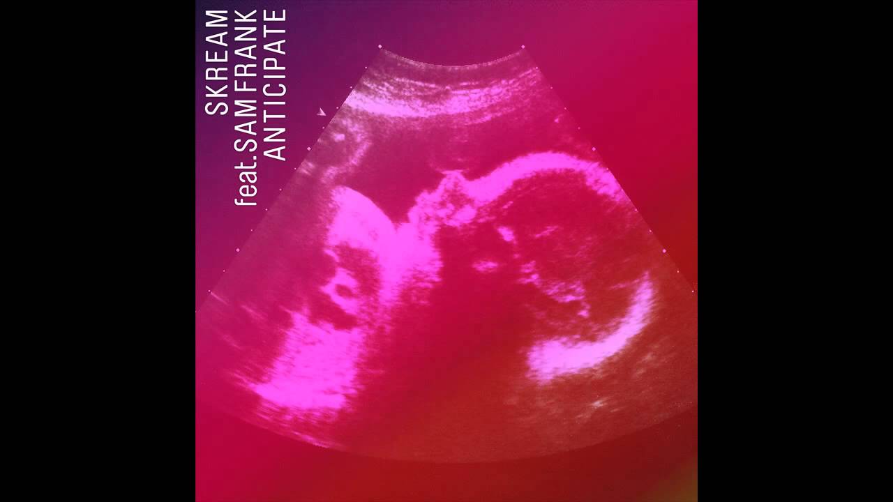 Skream &mdash; Anticipate ft. Sam Frank (Netsky Remix) [Official]
