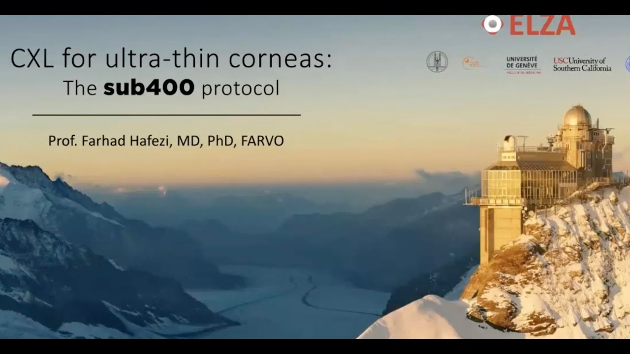 Cross-Linking for keratoconus in ultra-thin corneas (german and english subtitles)