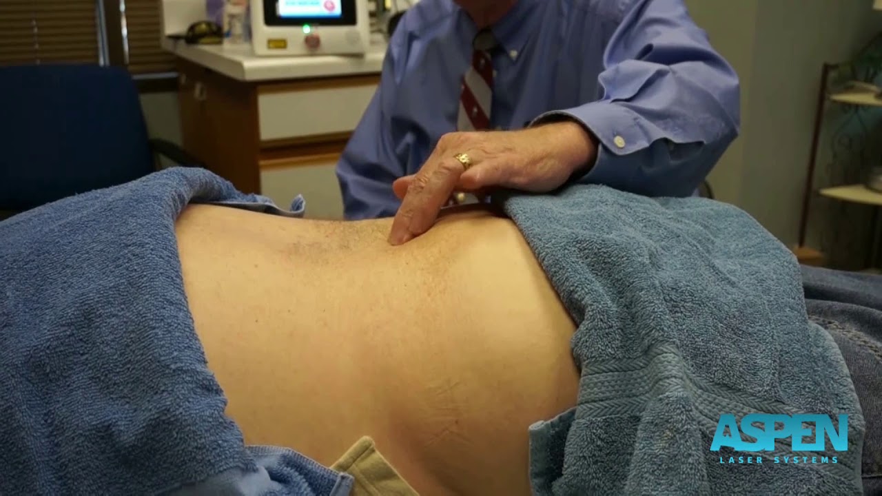 Laser Therapy Treatment for Lower Back Pain/Herniated Disc with Class IV Laser