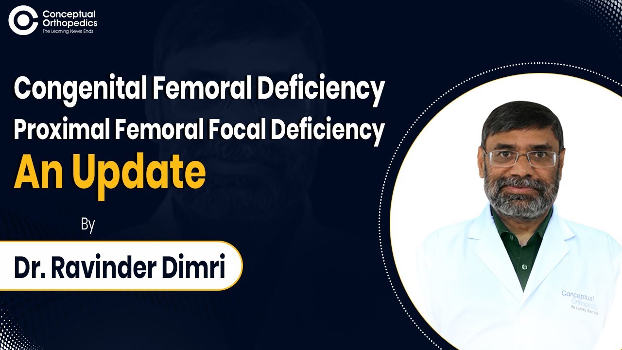 Congenital Femoral Deficiency & Proximal Femoral Focal Deficiency - An Update | Dr. Ravinder Dimri
